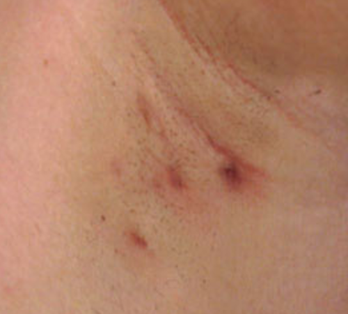 skin issue